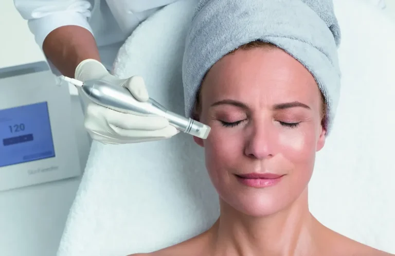 Microneedling in Nürnberg bei Emilia Timeless Elegance